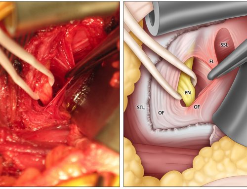 Cirugía en el S.A.N.P.