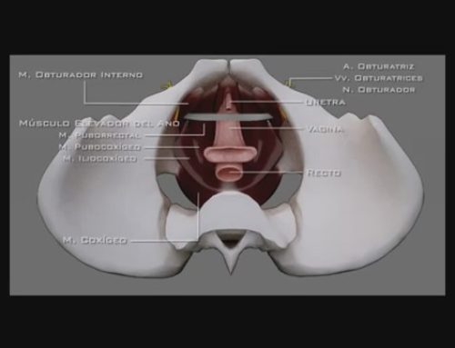 Dolor genital tras cirugía de incontinencia: cuando no todo es un síndrome de atrapamiento del nervio pudendo